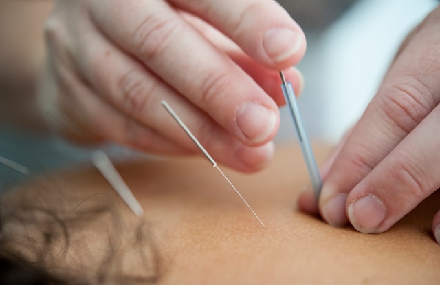 Traditional Chinese Medicine 2